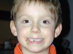 Garrett's first tooth Dec 2004